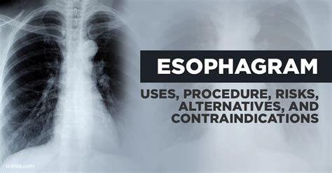 esophagram vs endoscopy